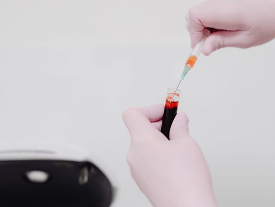 Badania krwi Warszawa Ursynów – diagnostyka laboratoryjna blisko Ciebie