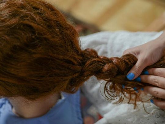 Dyskomfort wynikający z popękanej skóry głowy – jak przyspieszyć regenerację?